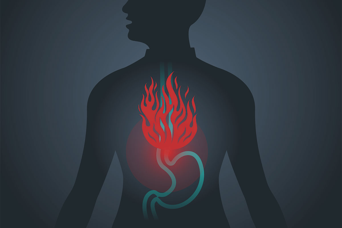 Reflujo-gastroesofágico REFLUJO GASTROESOFÁGICO: CONSEJOS PRÁCTICOS Y NUTRICIONALES